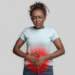 Retrograde Menstruation